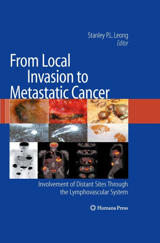 From Local Invasion to Metastatic Cancer 1st Edition Involvement of Distant Sites Through the Lymphovascular System  - E-Book and test bank